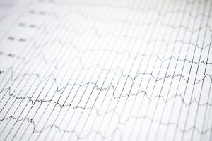 EEG electrophysiological monitoring method