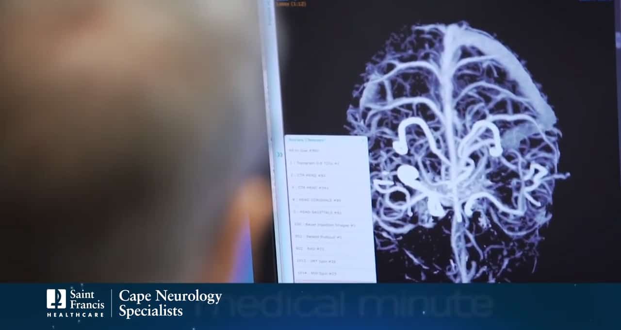 Video: Medical Minute: Decreasing the Risk of Stroke with Dr. Randall ...